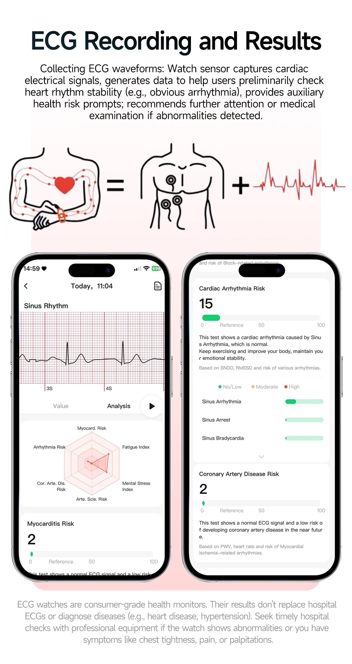 2026 Top Nursing Grade ECG+PPG Smart Watch Men Accurate Blood Pressure Lipids Uric Acid 2.0-inch AMOLED Screen HD Call Watch Men