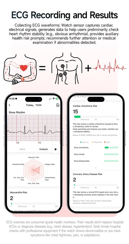 2026 Top Nursing Grade ECG+PPG Smart Watch Men Accurate Blood Pressure Lipids Uric Acid 2.0-inch AMOLED Screen HD Call Watch Men